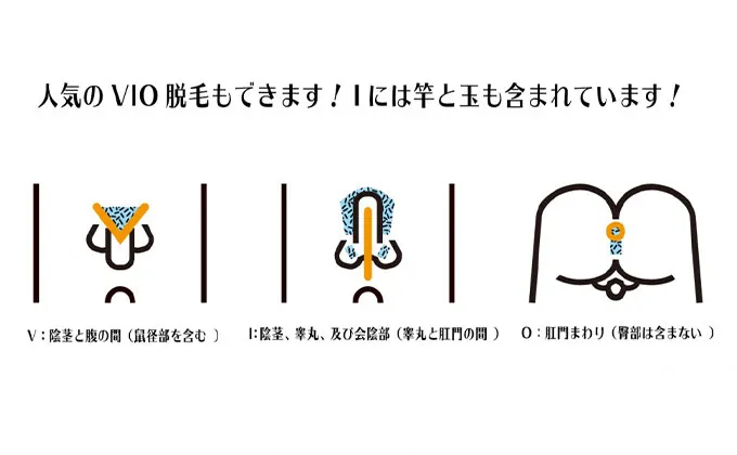 VIO脱毛範囲