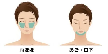 脱毛範囲
