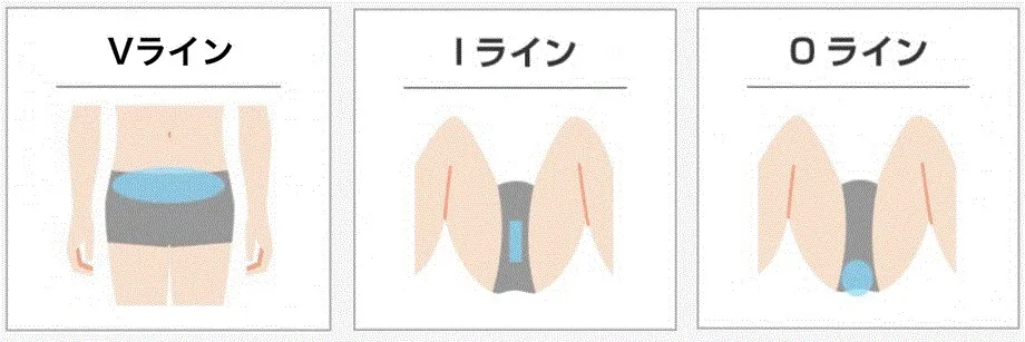 脱毛範囲
