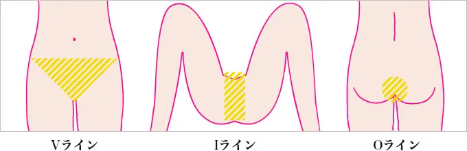 脱毛範囲