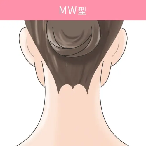 MW型