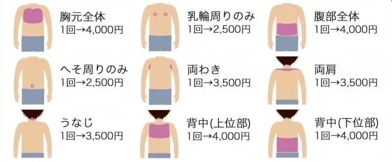 脱毛範囲