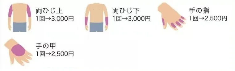 脱毛範囲