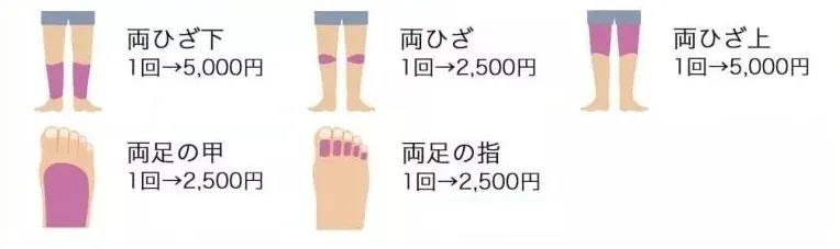 脱毛範囲