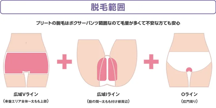 VIOの脱毛範囲